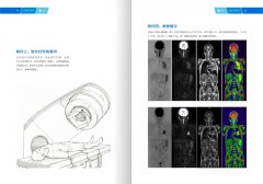 西藏康城肿瘤医院开展MR类PET成像技术